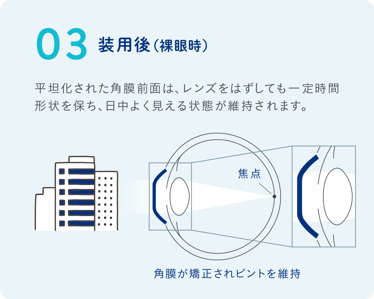 装用後（裸眼時）